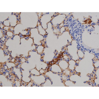 STAT6 Antibody - 1:200 staining mouse lung tissue by IHC-P. The tissue was formaldehyde fixed and a heat mediated antigen retrieval step in citrate buffer was performed. The tissue was then blocked and incubated with the antibody for 1.5 hours at 22°C. An HRP conjugated goat anti-rabbit antibody was used as the secondary.