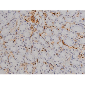 STAT6 Antibody - 1:200 staining rat kidney tissue by IHC-P. The tissue was formaldehyde fixed and a heat mediated antigen retrieval step in citrate buffer was performed. The tissue was then blocked and incubated with the antibody for 1.5 hours at 22°C. An HRP conjugated goat anti-rabbit antibody was used as the secondary.