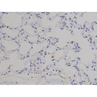 STAT6 Antibody - 1:200 staining rat lung tissue by IHC-P. The tissue was formaldehyde fixed and a heat mediated antigen retrieval step in citrate buffer was performed. The tissue was then blocked and incubated with the antibody for 1.5 hours at 22°C. An HRP conjugated goat anti-rabbit antibody was used as the secondary.