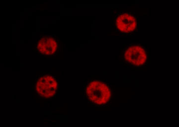 STAT6 Antibody - Staining HeLa cells by IF/ICC. The samples were fixed with PFA and permeabilized in 0.1% Triton X-100, then blocked in 10% serum for 45 min at 25°C. The primary antibody was diluted at 1:200 and incubated with the sample for 1 hour at 37°C. An Alexa Fluor 594 conjugated goat anti-rabbit IgG (H+L) Ab, diluted at 1/600, was used as the secondary antibody.