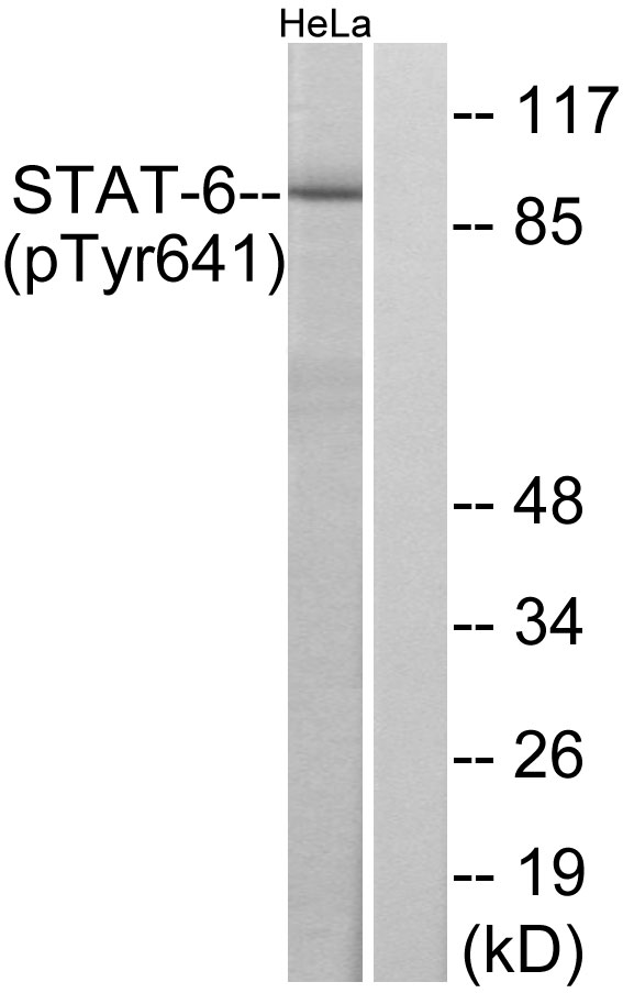 STAT6 Antibody - Western blot analysis of lysates from HeLa cells treated with IL-4, using STAT6 (Phospho-Tyr641) Antibody. The lane on the right is blocked with the phospho peptide.