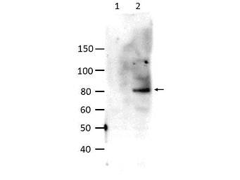 STAT6 Antibody - Western blot of Rabbit anti-STAT6 pY641 antibody. Lane 1: unstimulated HeLa cell lysate. Lane 2: IL-4 stimulated HeLa cell lysate. Load: 10 ug per lane. Primary antibody: STAT6 pY641 antibody at 1:1000 for overnight at 4C. Secondary antibody: HRP goat anti-rabbit at 1:40000 for 30 min at RT. Block: 5% Blotto, 30 min at RT. Predicted/Observed size: 94 kDa, 90 kDa. Other band(s): unspecific bands.