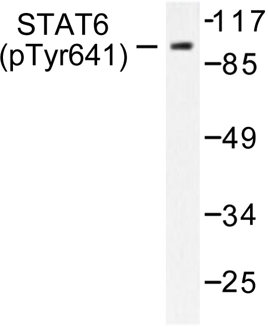 STAT6 Antibody - Western blot of p-STAT6 (Y641) pAb in extracts from HeLa cells.