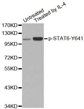 STAT6 Antibody - Western blot analysis of extracts from Hela cells.