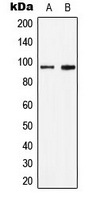 STAT6 Antibody - Western blot analysis of STAT6 (pY641) expression in HepG2 IL4-treated (A); HeLa IL-4-treated (B) whole cell lysates.