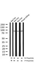 STAT6 Antibody - Western blot analysis of Tyrosinase expression in COS7 cells. The lane on the left is treated with the antigen-specific peptide.