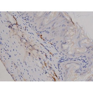 STAT6 Antibody - 1:200 staining mouse ganstric tissue by IHC-P. The tissue was formaldehyde fixed and a heat mediated antigen retrieval step in citrate buffer was performed. The tissue was then blocked and incubated with the antibody for 1.5 hours at 22°C. An HRP conjugated goat anti-rabbit antibody was used as the secondary.