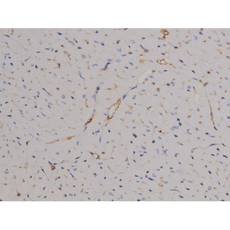 STAT6 Antibody - 1:200 staining mouse heart tissue by IHC-P. The tissue was formaldehyde fixed and a heat mediated antigen retrieval step in citrate buffer was performed. The tissue was then blocked and incubated with the antibody for 1.5 hours at 22°C. An HRP conjugated goat anti-rabbit antibody was used as the secondary.