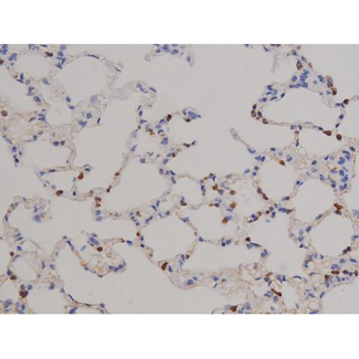 STAT6 Antibody - 1:200 staining rat lung tissue by IHC-P. The tissue was formaldehyde fixed and a heat mediated antigen retrieval step in citrate buffer was performed. The tissue was then blocked and incubated with the antibody for 1.5 hours at 22°C. An HRP conjugated goat anti-rabbit antibody was used as the secondary.