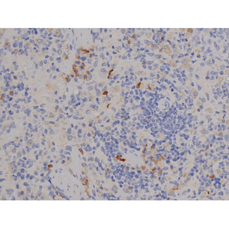 STAT6 Antibody - 1:200 staining rat spleen tissue by IHC-P. The tissue was formaldehyde fixed and a heat mediated antigen retrieval step in citrate buffer was performed. The tissue was then blocked and incubated with the antibody for 1.5 hours at 22°C. An HRP conjugated goat anti-rabbit antibody was used as the secondary.