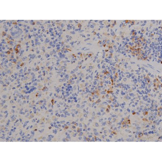 STAT6 Antibody - 1:200 staining rat spleen tissue by IHC-P. The tissue was formaldehyde fixed and a heat mediated antigen retrieval step in citrate buffer was performed. The tissue was then blocked and incubated with the antibody for 1.5 hours at 22°C. An HRP conjugated goat anti-rabbit antibody was used as the secondary.