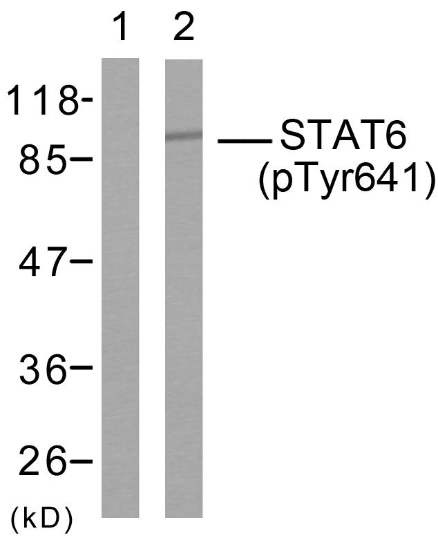 STAT6 Antibody - Western blot analysis using STAT6 (Phospho- Tyr641) Antibody: Line1: The extracts from HeLa cells; Line2: The extracts from HeLa cells treated with IL-4.