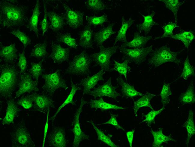 STAT6 Antibody - Immunofluorescence staining of STAT6 in Hela cells. Cells were fixed with 4% PFA, permeabilzed with 0.1% Triton X-100 in PBS, blocked with 10% serum, and incubated with rabbit anti-Human STAT6 polyclonal antibody (dilution ratio 1:500) at 4°C overnight. Then cells were stained with the Alexa Fluor 488-conjugated Goat Anti-rabbit IgG secondary antibody (green). Positive staining was localized to Nucleus.