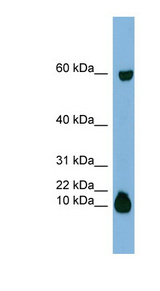 Statherin / STR Antibody - STATH / Statherin antibody Western blot of Fetal Thymus lysate. This image was taken for the unconjugated form of this product. Other forms have not been tested.