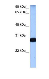 STAU1 / Staufen Antibody - 721_B cell lysate. Antibody concentration: 0.5 ug/ml. Gel concentration: 12%.  This image was taken for the unconjugated form of this product. Other forms have not been tested.