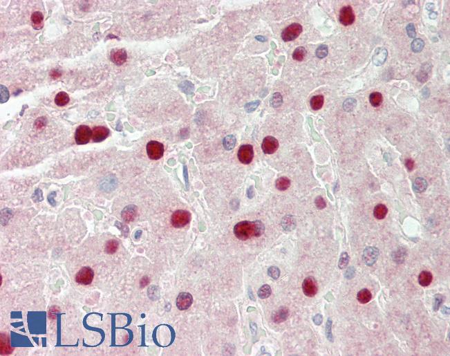 STAU1 / Staufen Antibody - Human Liver: Formalin-Fixed, Paraffin-Embedded (FFPE).  This image was taken for the unconjugated form of this product. Other forms have not been tested.