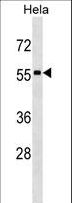 STAU1 / Staufen Antibody - STAU1 Antibody western blot of HeLa cell line lysates (35 ug/lane). The STAU1 antibody detected the STAU1 protein (arrow).