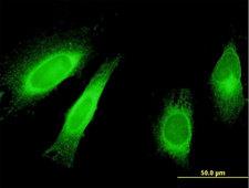 STAU1 / Staufen Antibody - Immunofluorescence of monoclonal antibody to STAU1 on HeLa cell . [antibody concentration 10 ug/ml]