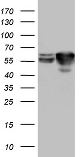 STAU1 / Staufen Antibody - HEK293T cells were transfected with the pCMV6-ENTRY control. (Left lane) or pCMV6-ENTRY STAU1. (Right lane) cDNA for 48 hrs and lysed
