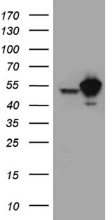 STAU1 / Staufen Antibody - HEK293T cells were transfected with the pCMV6-ENTRY control. (Left lane) or pCMV6-ENTRY STAU1. (Right lane) cDNA for 48 hrs and lysed. Equivalent amounts of cell lysates. (5 ug per lane) were separated by SDS-PAGE and immunoblotted with anti-STAU1. (1:2000)