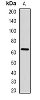 STAU1 / Staufen Antibody - Western blot analysis of STAU1 expression in HepG2 (A) whole cell lysates.