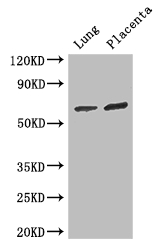 STAU1 / Staufen Antibody - Positive WB detected in:Mouse lung tissue,Human placenta tissue;All lanes: STAU1 antibody at 3ug/ml;Secondary;Goat polyclonal to rabbit IgG at 1/50000 dilution;Predicted band size: 64,55,56 kDa;Observed band size: 64 kDa;