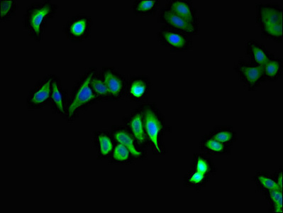STAU1 / Staufen Antibody - Immunofluorescent analysis of HepG2 cells using STAU1 Antibody at dilution of 1:100 and Alexa Fluor 488-congugated AffiniPure Goat Anti-Rabbit IgG(H+L)