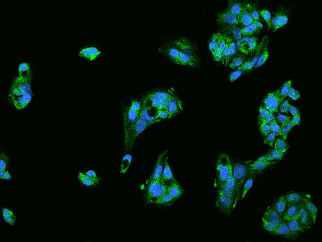STAU1 / Staufen Antibody - Immunofluorescence staining of STAU1 in HepG2 cells. Cells were fixed with 4% PFA, permeabilzed with 0.1% Triton X-100 in PBS, blocked with 10% serum, and incubated with rabbit anti-Human STAU1 polyclonal antibody (dilution ratio 1:200) at 4°C overnight. Then cells were stained with the Alexa Fluor 488-conjugated Goat Anti-rabbit IgG secondary antibody (green) and counterstained with DAPI (blue). Positive staining was localized to Cytoplasm.