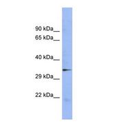STAU2 Antibody - Western blot of Human NCI-H226 Whole cell . STAU2 antibody dilution 1.0 ug/ml.  This image was taken for the unconjugated form of this product. Other forms have not been tested.