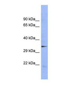 STAU2 Antibody - Western blot of Human NCI-H226 Whole cell . STAU2 antibody dilution 1.0 ug/ml.  This image was taken for the unconjugated form of this product. Other forms have not been tested.