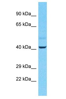 STAU2 Antibody - STAU2 antibody Western Blot of Lymph Tumor. Antibody dilution: 1 ug/ml.  This image was taken for the unconjugated form of this product. Other forms have not been tested.