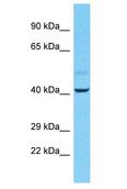 STAU2 Antibody - STAU2 antibody Western Blot of Lymph Tumor. Antibody dilution: 1 ug/ml.  This image was taken for the unconjugated form of this product. Other forms have not been tested.