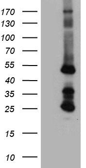 STBD1 Antibody - HEK293T cells were transfected with the pCMV6-ENTRY control. (Left lane) or pCMV6-ENTRY STBD1. (Right lane) cDNA for 48 hrs and lysed