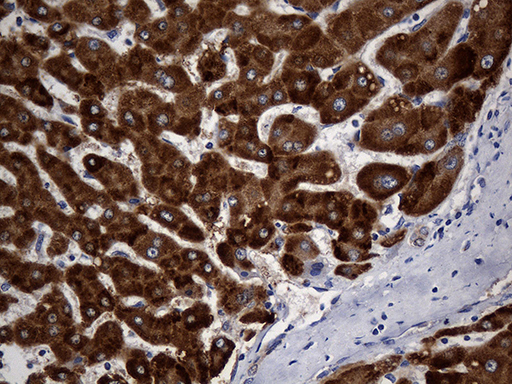 STBD1 Antibody - Immunohistochemical staining of paraffin-embedded Human liver tissue within the normal limits using anti-STBD1 mouse monoclonal antibody. (Heat-induced epitope retrieval by 1mM EDTA in 10mM Tris buffer. (pH8.5) at 120°C for 3 min. (1:2000)