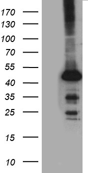 STBD1 Antibody - HEK293T cells were transfected with the pCMV6-ENTRY control. (Left lane) or pCMV6-ENTRY STBD1. (Right lane) cDNA for 48 hrs and lysed