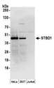 STBD1 Antibody - Detection of human STBD1 by western blot. Samples: Whole cell lysate (50 µg) from HeLa, HEK293T, and Jurkat cells prepared using RIPA lysis buffer. Antibodies: Affinity purified rabbit anti-STBD1 antibody used for WB at 0.1 µg/ml. Detection: Chemiluminescence with an exposure time of 30 seconds.