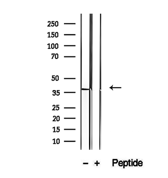 STBD1 Antibody - Western blot analysis of extracts of A549 cells using STBD1 antibody.