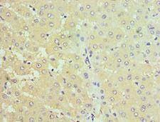 STC1 / Stanniocalcin Antibody - Immunohistochemistry of paraffin-embedded human liver using antibody at 1:100 dilution.
