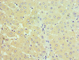STC1 / Stanniocalcin Antibody - Immunohistochemistry of paraffin-embedded human liver tissue using STC1 Antibody at dilution of 1:100
