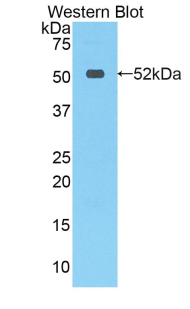 STC1 / Stanniocalcin Antibody - Western blot of recombinant STC1 / Stanniocalcin.  This image was taken for the unconjugated form of this product. Other forms have not been tested.