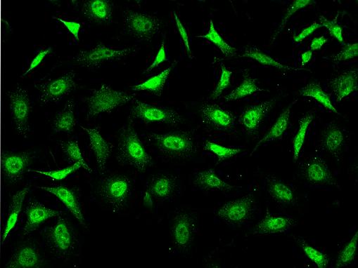 STC1 / Stanniocalcin Antibody - Immunofluorescence staining of STC1 in Hela cells. Cells were fixed with 4% PFA, permeabilzed with 0.1% Triton X-100 in PBS, blocked with 10% serum, and incubated with rabbit anti-Human STC1 polyclonal antibody (dilution ratio 1:200) at 4°C overnight. Then cells were stained with the Alexa Fluor 488-conjugated Goat Anti-rabbit IgG secondary antibody (green). Positive staining was localized to Nucleus.