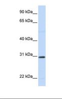 STC1 / Stanniocalcin Antibody - 721_B cell lysate. Antibody concentration: 1.0 ug/ml. Gel concentration: 12%.  This image was taken for the unconjugated form of this product. Other forms have not been tested.