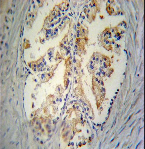 STC2 / Stanniocalcin 2 Antibody - STC2 Antibody immunohistochemistry of formalin-fixed and paraffin-embedded human prostate tissue followed by peroxidase-conjugated secondary antibody and DAB staining.