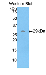 STC2 / Stanniocalcin 2 Antibody - Western blot of recombinant STC2 / Stanniocalcin 2.  This image was taken for the unconjugated form of this product. Other forms have not been tested.