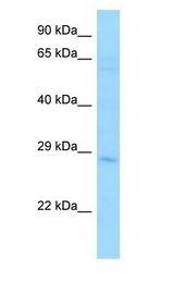 STC2 / Stanniocalcin 2 Antibody - STC2 / Stanniocalcin 2 antibody Western Blot of MCF7.  This image was taken for the unconjugated form of this product. Other forms have not been tested.
