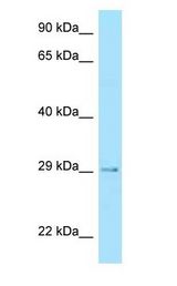 STC2 / Stanniocalcin 2 Antibody - STC2 / Stanniocalcin 2 antibody Western Blot of Fetal Heart.  This image was taken for the unconjugated form of this product. Other forms have not been tested.