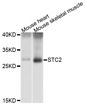 STC2 / Stanniocalcin 2 Antibody - Western blot analysis of extracts of various cell lines.
