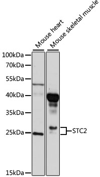 STC2 / Stanniocalcin 2 Antibody - Western blot analysis of extracts of various cell lines, using STC2 antibody at 1:1000 dilution. The secondary antibody used was an HRP Goat Anti-Rabbit IgG (H+L) at 1:10000 dilution. Lysates were loaded 25ug per lane and 3% nonfat dry milk in TBST was used for blocking. An ECL Kit was used for detection and the exposure time was 90s.