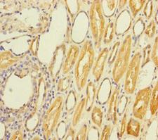 STC2 / Stanniocalcin 2 Antibody - Immunohistochemistry of paraffin-embedded human kidney tissue at dilution of 1:100