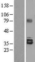 STC2 / Stanniocalcin 2 Protein - Western validation with an anti-DDK antibody * L: Control HEK293 lysate R: Over-expression lysate